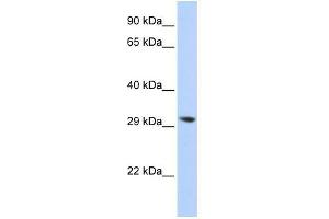 Image no. 1 for anti-Lysophospholipase II (LYPLA2) (N-Term) antibody (ABIN632189) (LYPLA2 antibody  (N-Term))