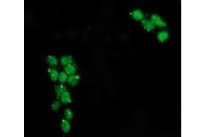 Anti-TP53 mouse monoclonal antibody (ABIN2454502) immunofluorescent staining of COS7 cells transiently transfected by pCMV6-ENTRY TP53 (RC200003). (p53 antibody)