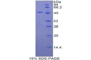 SDS-PAGE (SDS) image for Fibroblast Growth Factor 10 (FGF10) (AA 37-209) protein (His tag,GST tag) (ABIN1877618)