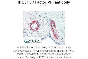 Image no. 2 for anti-Coagulation Factor VIII (F8) antibody (ABIN1723234) (Factor VIII antibody)