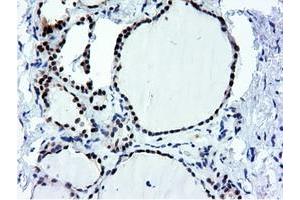Image no. 15 for anti-5'-Nucleotidase Domain Containing 1 (NT5DC1) antibody (ABIN1499838)