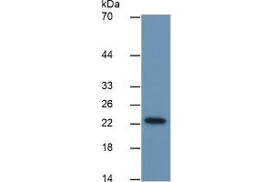 Mouse Capture antibody from the kit in WB with Positive Control: Sample Human MCF7 cell lysate. (GSTP1 ELISA Kit)
