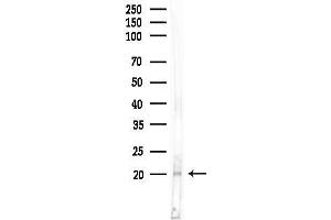 Western blot analysis of lysates from Rat liver, using APRT Antibody at 1/1000 dilution.