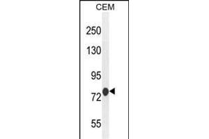 ATF7IP2 antibody  (AA 318-347)