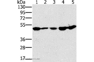 Western blot analysis of 231 and Jurkat cell, mouse liver tissue, 293T and hela cell, using PSMC2 Polyclonal Antibody at dilution of 1:400 (PSMC2 antibody)