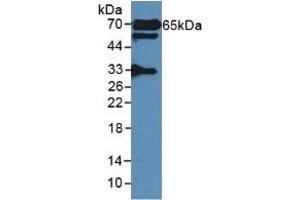 Detection of GAD2 in Rat Serum using Polyclonal Antibody to Glutamate Decarboxylase 2 (GAD2) (GAD65 antibody  (AA 188-374))