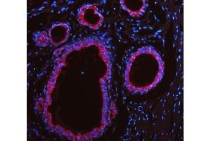IF analysis of Cytokeratin 19 using anti-Cytokeratin 19 antibody (ABIN3043288). (Cytokeratin 19 antibody  (C-Term))