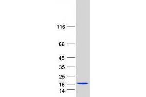 Validation with Western Blot