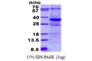 Image no. 1 for Tetratricopeptide Repeat Domain 33 (TTC33) (AA 1-262) protein (His tag) (ABIN6387031)