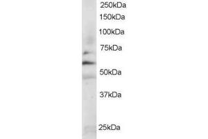 Western Blotting (WB) image for anti-FYN Oncogene Related To SRC, FGR, YES (FYN) (N-Term) antibody (ABIN184620)