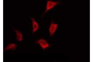 Immunofluorescence (fixed cells) (IF/ICC) image for anti-Microtubule-Associated Protein tau (MAPT) (pSer356) antibody (ABIN6256286)