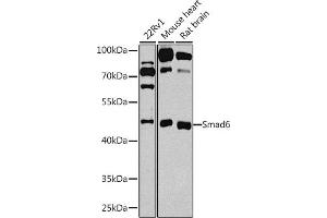 Western blot analysis of extracts of various cell lines, using Smad6 antibody (ABIN3015229, ABIN3015230, ABIN3015231 and ABIN6213893) at 1:1000 dilution. (SMAD6 antibody  (AA 257-496))