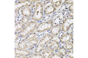 Immunohistochemistry of paraffin-embedded rat kidney using RNF166 antibody (ABIN5974659) (40x lens). (RNF166 antibody)