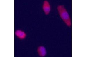 Immunofluorecence staining of anti-GPC3 Pab (cat (ABIN390319 and ABIN2840750)) on HepG2 cells.