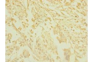 TAS1R3 antibody  (AA 400-570)