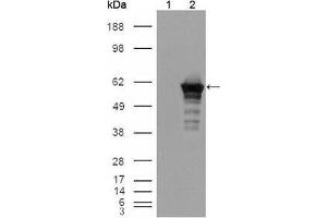 Western blot analysis using Desmin mouse mAb against HEK293T cells transfected with the pCMV6-ENTRY control (1) and pCMV6-ENTRY Desmin cDNA (2). (Desmin antibody)