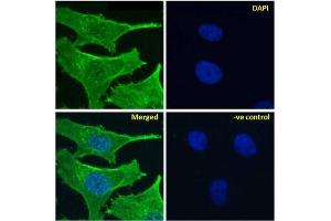 Immunofluoresence staining of fixed HeLa cells with anti-Notch 2 antibody B6. (Recombinant NOTCH2 antibody)