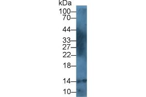 Detection of S100A12 in Human Leukocyte lysate using Polyclonal Antibody to S100 Calcium Binding Protein A12 (S100A12) (S100A12 antibody  (AA 2-92))