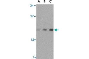 Western blot analysis of TMED10 in mouse brain tissue lysate with TMED10 polyclonal antibody  at (A) 0. (TMED10 antibody  (Internal Region))