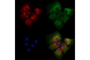 ABIN7094483 and ABIN7098532 staining  cells by IF/ICC.