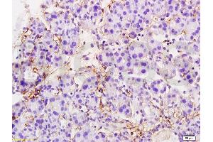 Formalin-fixed and paraffin embedded rat pancreas tissue labeled with Anti-MTUS1 Polyclonal Antibody, Unconjugated  at 1:200 followed by conjugation to the secondary antibody and DAB staining (MTUS1 antibody  (AA 1151-1270))