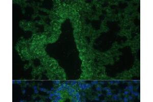 Immunofluorescence analysis of Mouse lung cells using IL25 Polyclonal Antibody at dilution of 1:100. (IL-25 antibody)