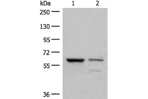 Western blot analysis of Human left kidney cancer tissue and HEPG2 cell lysates using HNF1A Polyclonal Antibody at dilution of 1:200 (HNF1A antibody)