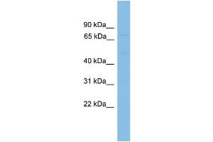 WB Suggested Anti-ADRBK1  Antibody Titration: 0. (GRK2 antibody  (C-Term))