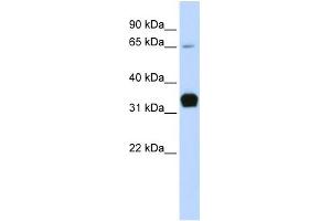 WB Suggested Anti-TNNT1 Antibody Titration:  0. (TNNT1 antibody  (Middle Region))