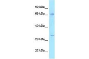 Image no. 1 for anti-Hydroxysteroid (17-Beta) Dehydrogenase 3 (HSD17B3) (AA 51-100) antibody (ABIN6747984) (HSD17B3 antibody  (AA 51-100))