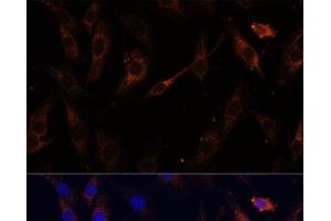 Immunofluorescence analysis of C6 cells using VPS25 Polyclonal Antibody at dilution of 1:100 (40x lens). (VPS25 antibody)
