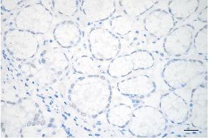 anti-serine/arginine-Rich Splicing Factor 6 (SRSF6) antibody