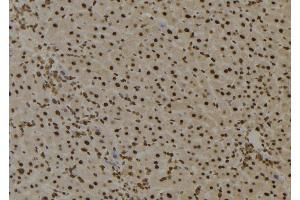 ABIN6276735 at 1/100 staining Mouse liver tissue by IHC-P. (BTK antibody  (Internal Region))