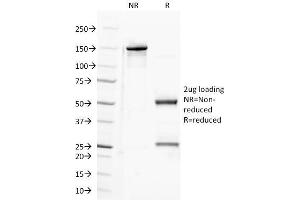 SDS-PAGE Analysis Purified CD100 Mouse Monoclonal Antibody (A8). (SEMA4D/CD100 antibody)