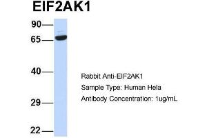 Host:  Rabbit  Target Name:  EIF2AK1  Sample Type:  Human Hela  Antibody Dilution:  1. (EIF2AK1 antibody  (N-Term))