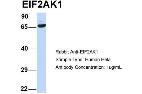 EIF2AK1 antibody  (N-Term)