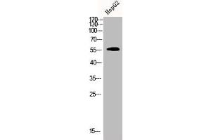 Western Blot analysis of HEPG2 cells using CDYL2 Polyclonal Antibody (CDYL2 antibody  (N-Term))