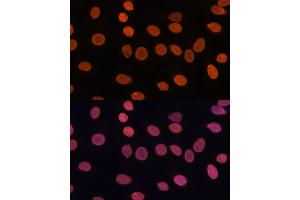 Immunofluorescence analysis of C6 cells using T antibody (ABIN7270900) at dilution of 1:100. (TADA3L antibody  (AA 270-369))