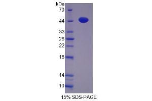 Image no. 1 for Proliferation-Associated 2G4, 38kDa (PA2G4) (AA 2-394) protein (His tag) (ABIN4990976)