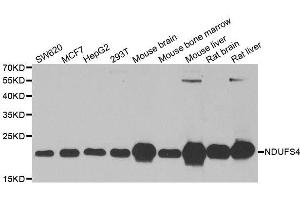 Western blot analysis of extracts of various cell lines, using NDUFS4 antibody. (NDUFS4 antibody  (AA 1-175))