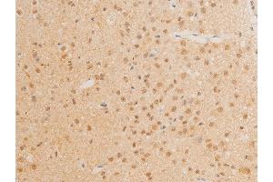 ABIN6267272 at 1/100 staining mouse brain tissue sections by IHC-P. (c-MYC antibody  (pThr58))