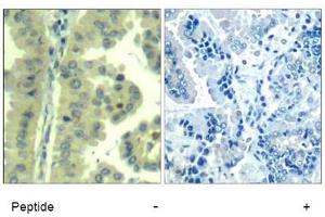 Image no. 3 for anti-Eukaryotic Translation Initiation Factor 4 Gamma, 1 (EIF4G1) (Ser1232) antibody (ABIN319387) (EIF4G1 antibody  (Ser1232))