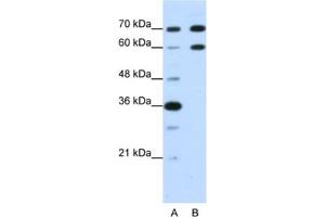 Western Blotting (WB) image for anti-Doublesex and Mab-3 Related Transcription Factor 2 (DMRT2) antibody (ABIN2462015) (DMRT2 antibody)