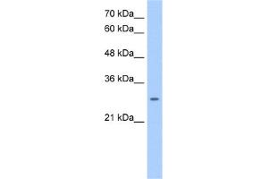 NRG1 (neuregulin 1) Antibody (against the middle region of NRG1) (50ug) validated by WB using Jurkat cell lysate at 0. (Neuregulin 1 antibody  (Middle Region))