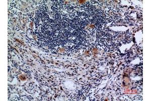Immunohistochemistry (IHC) analysis of paraffin-embedded Human Lung, antibody was diluted at 1:100.