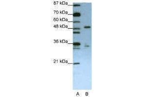 UPF3B antibody used at 1. (UPF3B antibody)