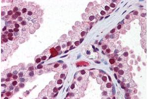 Human Prostate: Formalin-Fixed, Paraffin-Embedded (FFPE) (Retinoid X Receptor beta antibody  (AA 74-123))