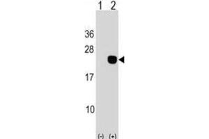 Western Blotting (WB) image for anti-DCMP Deaminase (DCTD) antibody (ABIN2998895) (DCMP Deaminase (DCTD) antibody)