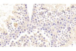 Detection of ACE2 in Mouse Testis Tissue using Polyclonal Antibody to Angiotensin I Converting Enzyme 2 (ACE2) (ACE2 antibody  (AA 93-464))