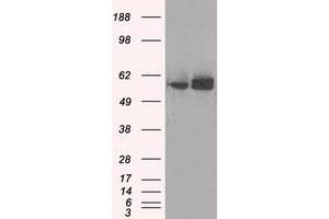 Image no. 5 for anti-ATP Synthase, H+ Transporting, Mitochondrial F1 Complex, beta Polypeptide (ATP5B) antibody (ABIN1496769) (ATP5B antibody)